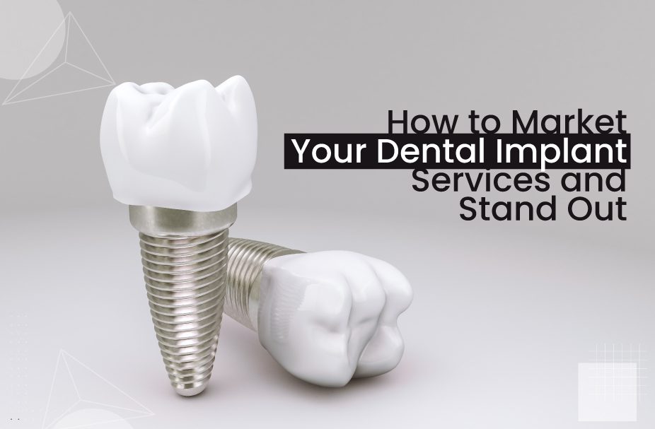 Marketing for Dental Implant Services