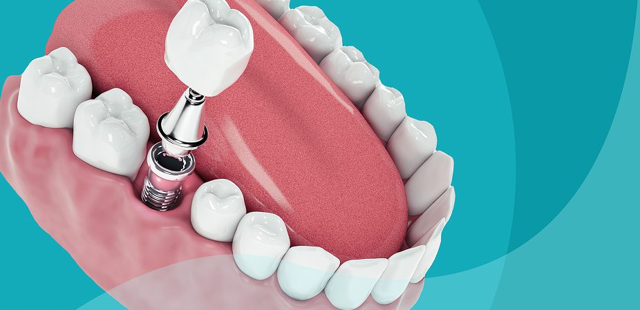 Mastering Case Selection and Treatment Planning